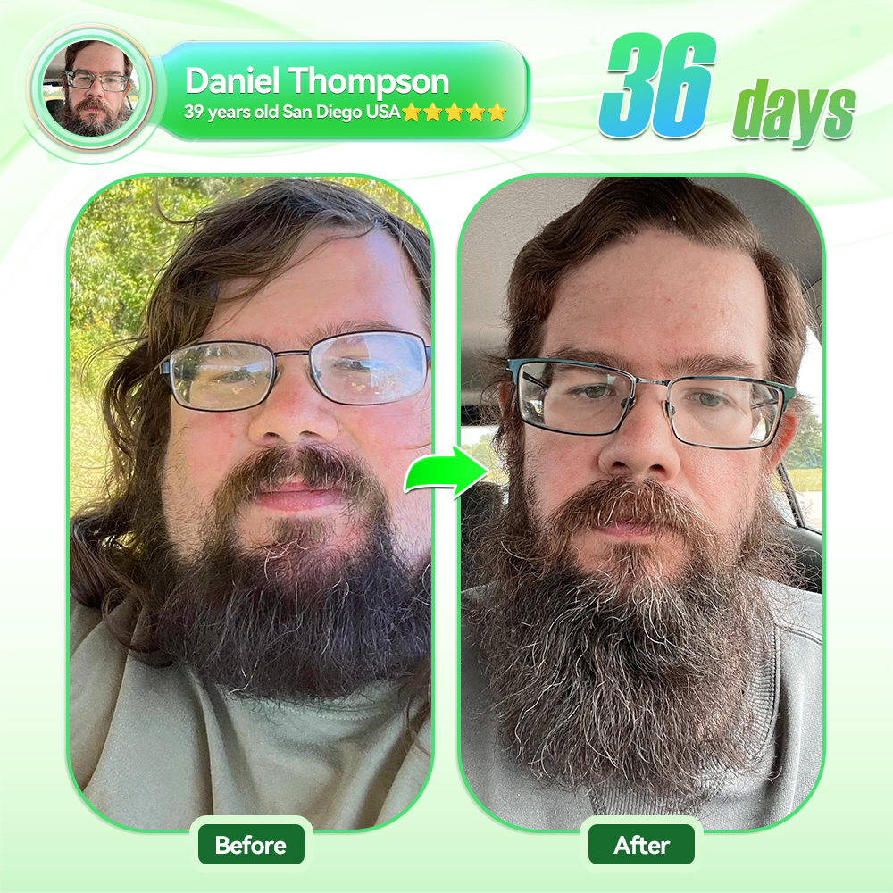 ๐บ๐ธ๐ถ๐๐๐๐๐๐๐ ๐บ๐๐๐๐|HH๐๐ยฎ ๐๐๐+ ๐๐๐-๐ Pro ALL-IN-ONE Fit&Vital ๐๐ซ๐๐ฅ ๐๐ข๐ช๐ฎ๐ข๐ (๐๐ฎ๐ฌ๐ญ ๐จ๐ง๐๐ ๐ ๐๐๐ฒ, ๐ฏ๐ข๐ฌ๐ข๐๐ฅ๐ ๐๐ก๐๐ง๐ ๐๐ฌ ๐ข๐ง ๐ ๐๐๐ฒ๐ฌ๏ผ โ
๐
๐จ๐ซ ๐จ๐๐๐ฌ๐ข๐ญ๐ฒ, ๐๐๐ซ๐๐ข๐จ๐ฏ๐๐ฌ๐๐ฎ๐ฅ๐๐ซ ๐ก๐๐๐ฅ๐ญ๐ก, ๐๐ข๐๐๐๐ญ๐๐ฌ, ๐ฌ๐ฅ๐๐๐ฉ ๐๐ฉ๐ง๐๐, ๐๐ฎ๐ญ ๐๐๐๐ฅ๐ญ๐ก, ๐ฃ๐จ๐ข๐ง๐ญ ๐ข๐ฌ๐ฌ๐ฎ๐๐ฌ, ๐๐ง๐ ๐ฆ๐จ๐ซ๐