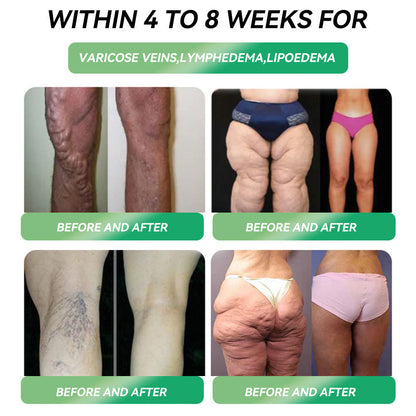 Persistence = Results! 30% HHVB discount for a limited time. Many users choose to purchase 6 boxes at a time (60 DAYS usage) as this not only stabilizes the results, but also allows them to take advantage of the awesome combo offer! 👍