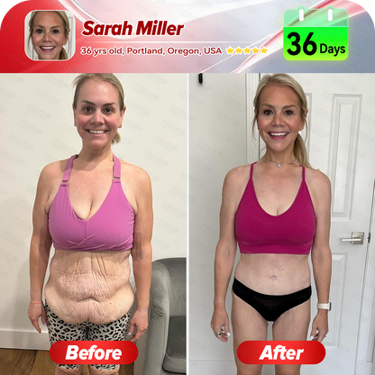 🇺🇸𝑶𝒇𝒇𝒊𝒄𝒊𝒂𝒍 𝑺𝒕𝒐𝒓𝒆𝑰𝐻𝐻𝑉𝐵®🌿𝑮𝑳𝑷-1+𝑪𝒐𝒍𝒍𝒂𝒈𝒆𝒏 𝑷𝒆𝒑𝒕𝒊𝒅𝒆𝒔 𝑾𝒆𝒊𝒈𝒉𝒕 𝑳𝒐𝒔𝒔&𝑭𝒊𝒓𝒎𝒊𝒏𝒈 𝑶𝒓𝒂𝒍 𝑺𝒐𝒍𝒖𝒕𝒊𝒐𝒏 𝒘𝒊𝒕𝒉 🔥𝑪𝒐𝒍𝒍𝒂𝒈𝒆𝒏 𝑷𝒆𝒑𝒕𝒊𝒅𝒆𝒔 & 𝑴𝒂𝒕𝒓𝒊𝒙𝒚𝒍 3000 𝒉𝒆𝒍𝒑𝒔 𝒕𝒂𝒓𝒈𝒆𝒕 ✅𝒐𝒃𝒆𝒔𝒊𝒕𝒚, 𝒇𝒊𝒓𝒎𝒔 𝒔𝒌𝒊𝒏,𝒄𝒂𝒓𝒅𝒊𝒐𝒗𝒂𝒔𝒄𝒖𝒍𝒂𝒓 𝒅𝒊𝒔𝒆𝒂𝒔𝒆, 𝒅𝒊𝒂𝒃𝒆𝒕𝒆𝒔, 𝒔𝒍𝒆𝒆𝒑 𝒂𝒑𝒏𝒆𝒂, 𝒋𝒐𝒊𝒏𝒕 𝒑𝒓𝒐𝒃𝒍𝒆𝒎𝒔, 𝒂𝒏𝒅 𝒎𝒐𝒓𝒆,