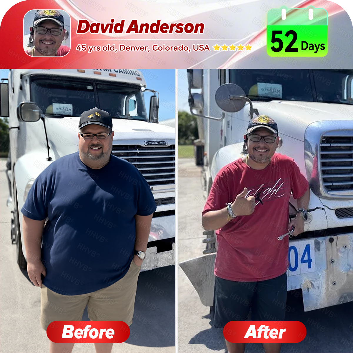 🇺🇸𝑶𝒇𝒇𝒊𝒄𝒊𝒂𝒍 𝑺𝒕𝒐𝒓𝒆𝑰𝐻𝐻𝑉𝐵®🌿𝑮𝑳𝑷-1+𝑪𝒐𝒍𝒍𝒂𝒈𝒆𝒏 𝑷𝒆𝒑𝒕𝒊𝒅𝒆𝒔 𝑾𝒆𝒊𝒈𝒉𝒕 𝑳𝒐𝒔𝒔&𝑭𝒊𝒓𝒎𝒊𝒏𝒈 𝑶𝒓𝒂𝒍 𝑺𝒐𝒍𝒖𝒕𝒊𝒐𝒏 𝒘𝒊𝒕𝒉 🔥𝑪𝒐𝒍𝒍𝒂𝒈𝒆𝒏 𝑷𝒆𝒑𝒕𝒊𝒅𝒆𝒔 & 𝑴𝒂𝒕𝒓𝒊𝒙𝒚𝒍 3000 𝒉𝒆𝒍𝒑𝒔 𝒕𝒂𝒓𝒈𝒆𝒕 ✅𝒐𝒃𝒆𝒔𝒊𝒕𝒚, 𝒇𝒊𝒓𝒎𝒔 𝒔𝒌𝒊𝒏,𝒄𝒂𝒓𝒅𝒊𝒐𝒗𝒂𝒔𝒄𝒖𝒍𝒂𝒓 𝒅𝒊𝒔𝒆𝒂𝒔𝒆, 𝒅𝒊𝒂𝒃𝒆𝒕𝒆𝒔, 𝒔𝒍𝒆𝒆𝒑 𝒂𝒑𝒏𝒆𝒂, 𝒋𝒐𝒊𝒏𝒕 𝒑𝒓𝒐𝒃𝒍𝒆𝒎𝒔, 𝒂𝒏𝒅 𝒎𝒐𝒓𝒆,